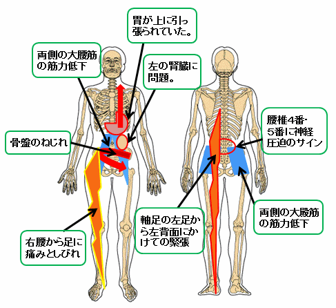 首、肩、腕,脚の痛み、しびれ12